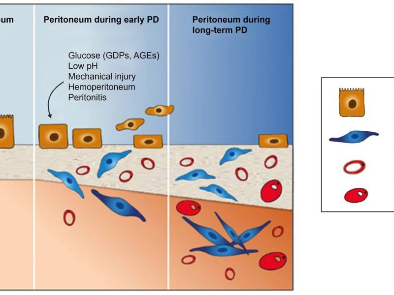 Characterized Peritoneal Fibrosis Models for Renal Research